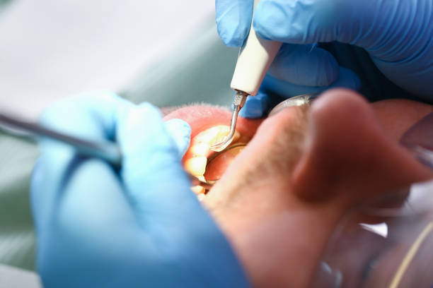Best Emergency Denture Repair in St Lawrence, PA
