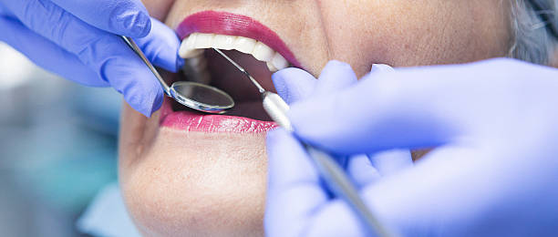 Best Emergency Dental Care for Broken or Chipped Teeth in St Lawrence, PA