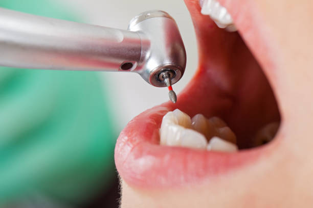 Best Pediatric Emergency Dentist in St Lawrence, PA